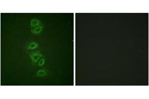 Immunofluorescence analysis of A549 cells, using PP2A-alpha (Phospho-Tyr307) Antibody. (PPP2CA anticorps  (pTyr307))