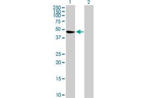 Western Blot analysis of TRIM47 expression in transfected 293T cell line by TRIM47 MaxPab polyclonal antibody. (TRIM47 anticorps  (AA 1-400))