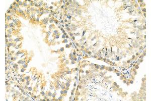 ABIN6258767 and ABIN6274328 at 1/100 staining Rat testis tissue by IHC-P.