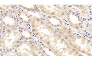 Detection of RBP4 in Human Kidney Tissue using Monoclonal Antibody to Retinol Binding Protein 4 (RBP4) (RBP4 anticorps  (AA 18-201))
