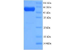 SDS-PAGE (SDS) image for Septin 7 (SEPT7) (AA 2-437) protein (His tag) (ABIN5714334)