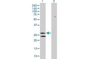 Western Blot analysis of ATP5F1 expression in transfected 293T cell line by ATP5F1 MaxPab polyclonal antibody. (ATP5F1 anticorps  (AA 1-256))