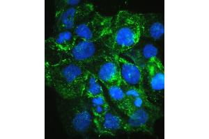 IF analysis of VEGF Receptor 3 using anti-VEGF Receptor 3 antibody (ABIN5693136). (FLT4 anticorps  (AA 25-259))