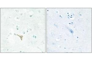 Immunohistochemistry analysis of paraffin-embedded human brain tissue, using RECK Antibody. (RECK anticorps  (AA 21-70))
