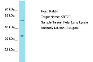 Host: Rabbit Target Name: KRT79 Sample Tissue: Human Fetal Lung Antibody Dilution: 1ug/ml (Cytokeratin 79 anticorps  (C-Term))