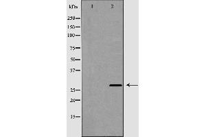 Western blot analysis of Cathepsin G expression in COLO cells,The lane on the left is treated with the antigen-specific peptide. (Cathepsin G anticorps  (Internal Region))