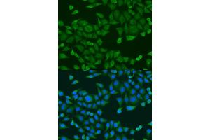 Immunofluorescence analysis of U2OS cells using RPS27A antibody (ABIN1874657) at dilution of 1:100. (RPS27A anticorps)
