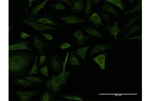Immunofluorescence of monoclonal antibody to COL5A2 on HeLa cell.