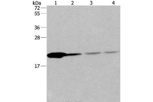 Western Blot analysis of Human fetal liver tissue and 293T cell, Human liver cancer tissue and hela cell using PPIB Polyclonal Antibody at dilution of 1:500 (PPIB anticorps)