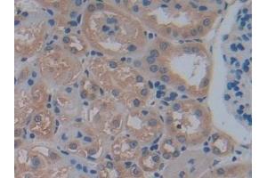 Detection of PFKP in Mouse Kidney Tissue using Polyclonal Antibody to Phosphofructokinase, Platelet (PFKP)