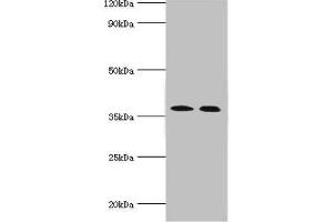 Western blot All lanes: Carbonic anhydrase 14 antibody at 5 μg/mL Lane 1: Mouse liver tissue Lane 2: Jurkat whole cell lysate Secondary Goat polyclonal to rabbit IgG at 1/10000 dilution Predicted band size: 38 kDa Observed band size: 38 kDa (CA14 anticorps  (AA 16-290))