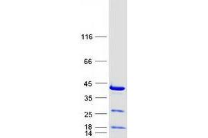 Validation with Western Blot