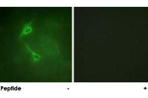 Immunofluorescence analysis of NIH/3T3 cells, using PRKCZ polyclonal antibody . (PKC zeta anticorps)