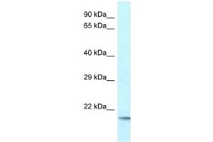 Western Blot showing UBE2V1 antibody used at a concentration of 1 ug/ml against Fetal Brain Lysate (UBE2V1 anticorps  (C-Term))