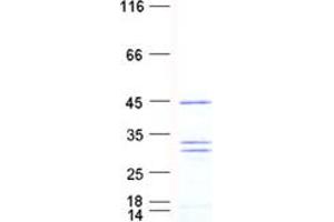 Validation with Western Blot
