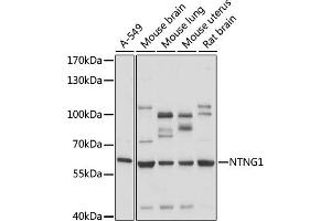 Western blot analysis of extracts of various cell lines, using NTNG1 antibody (ABIN7268853) at 1:1000 dilution.