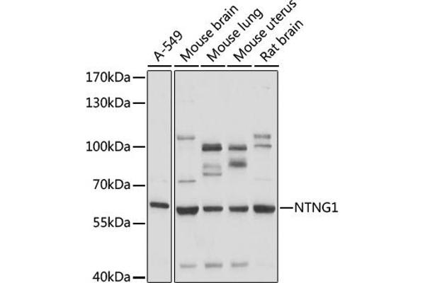 Netrin G1 anticorps  (AA 29-300)