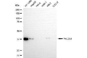 Western blotting analysis using PHLDA1 antibody (ABIN7799853).
