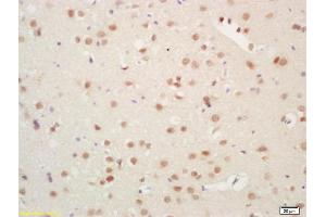 Formalin-fixed and paraffin embedded rat brain labeled with Rabbit Anti Histone H3 Polyclonal Antibody, Unconjugated (ABIN739109) at 1:200 followed by conjugation to the secondary antibody and DAB staining (Histone 3 anticorps  (AA 71-136))
