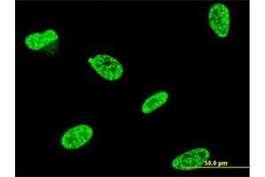 Immunofluorescence of monoclonal antibody to TP53RK on HeLa cell. (TP53RK anticorps  (AA 154-253))