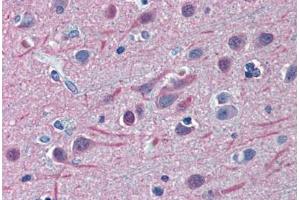 Human Brain, Cortex: Formalin-Fixed, Paraffin-Embedded (FFPE) (TUBB2A anticorps  (AA 1-446))