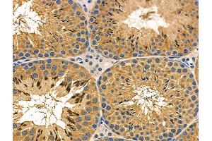 ABIN6257514 and ABIN6276058 at 1/100 staining Mouse testis tissue by IHC-P. (TACR1 anticorps  (Internal Region))