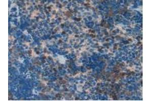 Detection of S100A11 in Rat Spleen Tissue using Polyclonal Antibody to S100 Calcium Binding Protein A11 (S100A11)