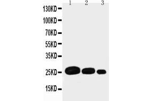 Anti-Adiponectin antibody, Western blottingRecombinant Protein Detection Source: E.
