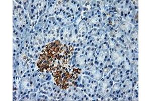 Immunohistochemical staining of paraffin-embedded Kidney tissue using anti-PLEKmouse monoclonal antibody. (Pleckstrin anticorps)
