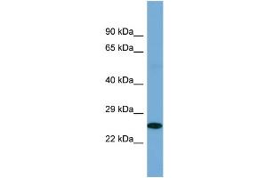 Host: Rabbit Target Name: POU2F3 Sample Type: Fetal Kidney lysates Antibody Dilution: 1. (POU2F3 anticorps  (C-Term))