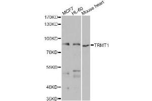 Western blot analysis of extracts of various cell lines, using TRMT1 antibody (ABIN5975089) at 1/1000 dilution. (TRMT1 anticorps)