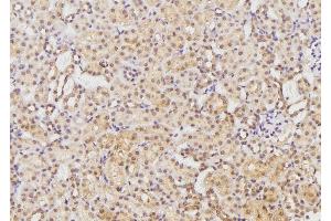 ABIN6269282 at 1/100 staining Rat kidney tissue by IHC-P. (EFNB1/2 anticorps)