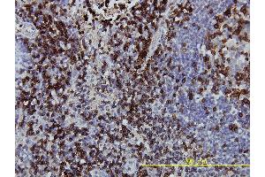 anti-CD247 Molecule (CD247) (AA 1-164) antibody