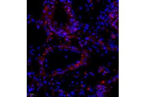 Immunofluorescence of paraffin embedded mouse lung using Thymosin (ABIN7075306) at dilution of 1:1000 (400x lens)
