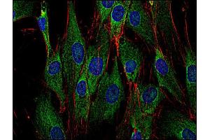 Western Blotting analysis (reducing conditions) of human Sos using anti-Sos (SOS-01). (Sos anticorps)
