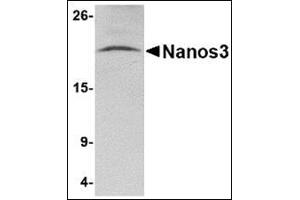 Western blot analysis of Nanos3 in human brain tissue lysate with this product at 2 μg/ml. (NANOS3 anticorps  (C-Term))