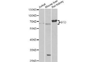 Western blot analysis of extracts of various cell lines, using BTD antibody (ABIN6290108) at 1:1000 dilution. (BTD anticorps)