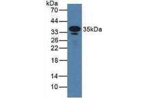 Detection of CD23 in Mouse Serum using Polyclonal Antibody to Cluster Of Differentiation 23 (CD23) (FCER2 anticorps  (AA 150-330))