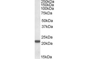 Western Blotting (WB) image for anti-Proteasome (Prosome, Macropain) Subunit, beta Type, 8 (Large Multifunctional Peptidase 7) (PSMB8) (C-Term) antibody (ABIN2464158) (PSMB8 anticorps  (C-Term))