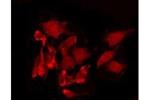 ABIN6268860 staining SKOV3 by IF/ICC.