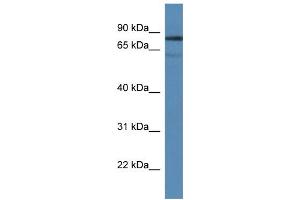 WB Suggested Anti-Tdp1 Antibody Titration: 1.