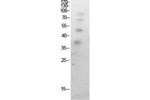 Western Blot (WB) analysis of HeLa cells using Acetyl-Ub (K27) Polyclonal Antibody. (Ubiquitin anticorps  (acLys27))