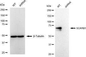 Western blotting analysis using SCARB1 antibody (ABIN7800276).