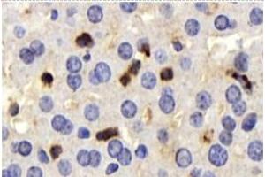Immunohistochemistry analysis of paraffin-embedded mouse liver using,CD63 (ABIN7073400) at dilution of 1: 750