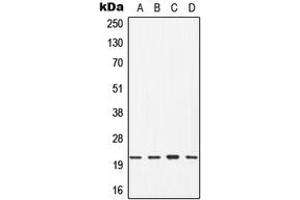 Western blot analysis of CDC42 expression in Jurkat (A), HT29 (B), mouse brain (C), rat liver (D) whole cell lysates. (CDC42 anticorps  (Center))