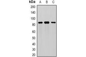 Western blot analysis of MEP1A expression in mouse intestine (A), mouse pancreas (B), rat kidney (C) whole cell lysates. (MEP1A anticorps)