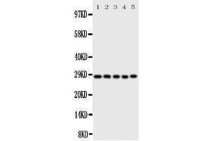 Western Blotting (WB) image for anti-Caspase 14, Apoptosis-Related Cysteine Peptidase (CASP14) (AA 223-242), (C-Term) antibody (ABIN3043977) (CASP14 anticorps  (C-Term))