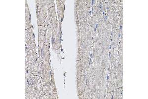 Immunohistochemistry of paraffin-embedded mouse heart using SLC2A3 antibody (ABIN5974794) (40x lens). (SLC2A3 anticorps)
