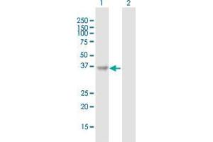 Western Blot analysis of QPCT expression in transfected 293T cell line by QPCT MaxPab polyclonal antibody.