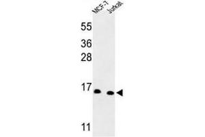 Western blot analysis of SNRPD3 Antibody (C-term) in MCF-7, Jurkat cell line lysates (35µg/lane).